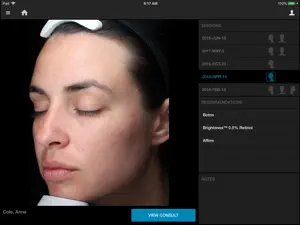 VISIA® screenshot 1