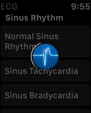 Instant ECG Mastery of EKG on the App Store