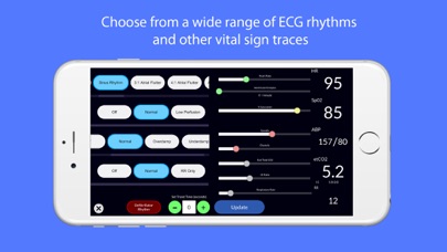 Simpl Patient Monitor Screenshot