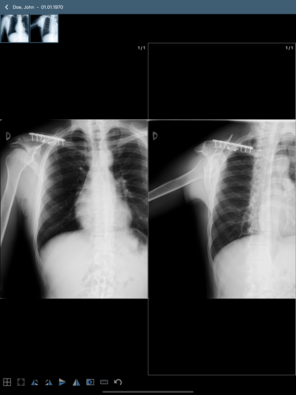 Screenshot #6 pour Issa PACS Client