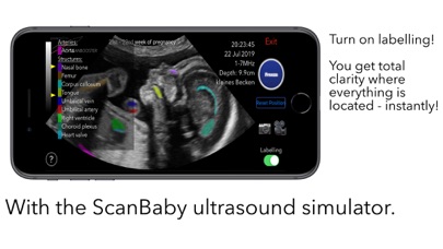 ScanBaby 赤ちゃんの超音波を学ぶのおすすめ画像6