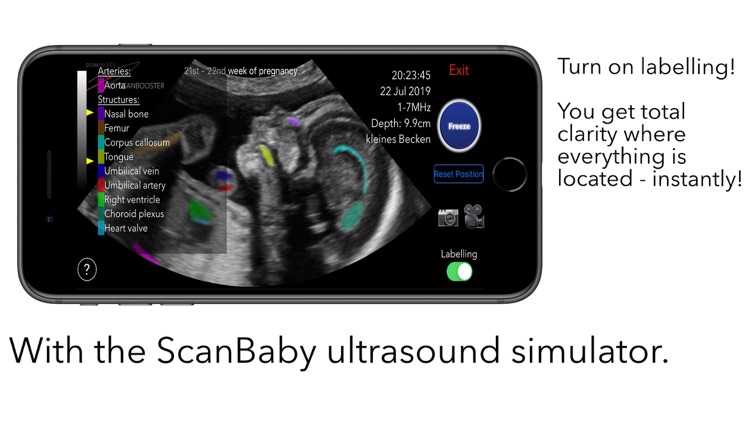 ScanBaby learn baby ultrasound screenshot-5