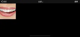 Game screenshot 小镜口腔镜 hack