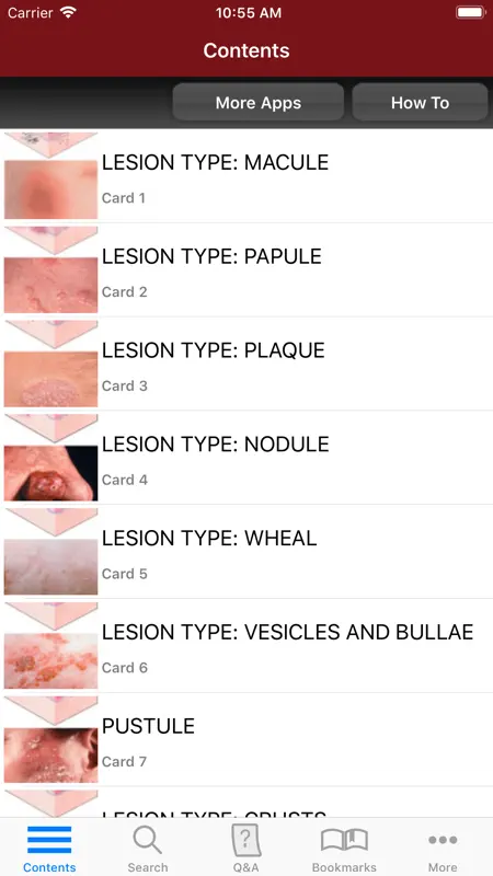 Fitzpatrick's Derm Flash Cards screenshot 2 of 5