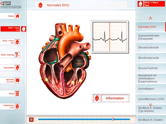Screenshot #5 pour ECGinMotion Abo