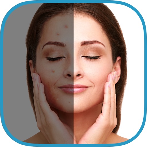 Cool Pimple Eraser plus icon