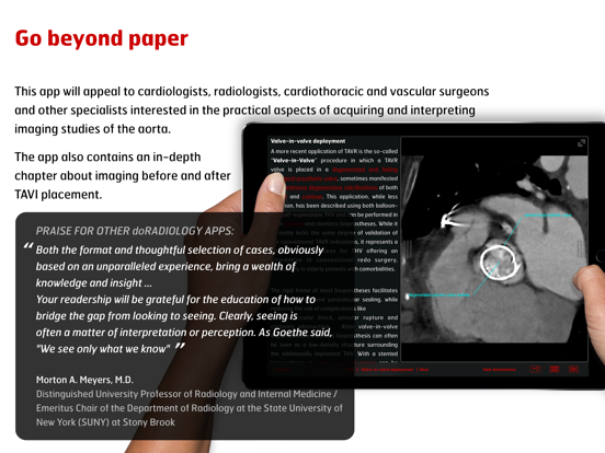 Screenshot #5 pour Radiology - Aortic Imaging