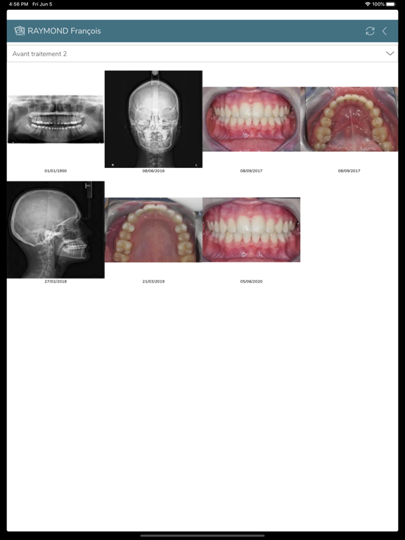 Screenshot #6 pour Dental Photos