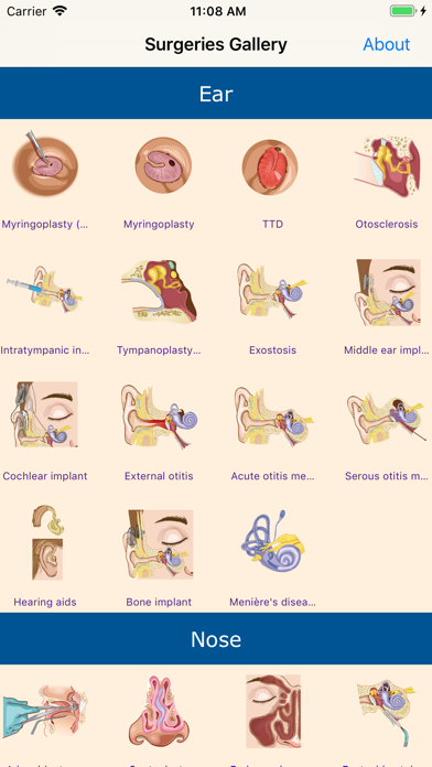 Screenshot #1 pour SeeENT