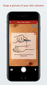 STD Triage Ask dermatologist screenshot
