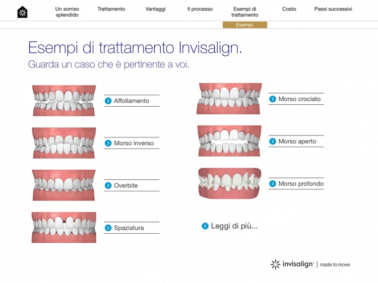 Invisalign Go Consultations screenshot-3