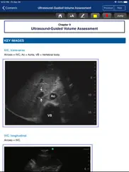point of care ultrasound guide ipad bildschirmfoto 3