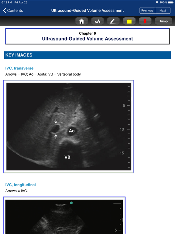 Screenshot #6 pour Point of Care Ultrasound Guide