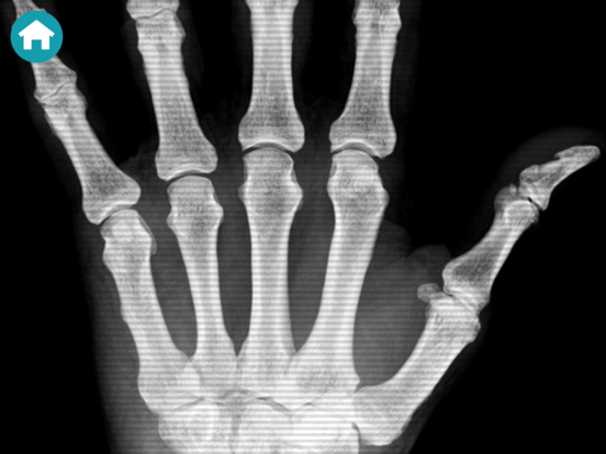 X-Ray Scanner Simulator Prank iPad screenshot