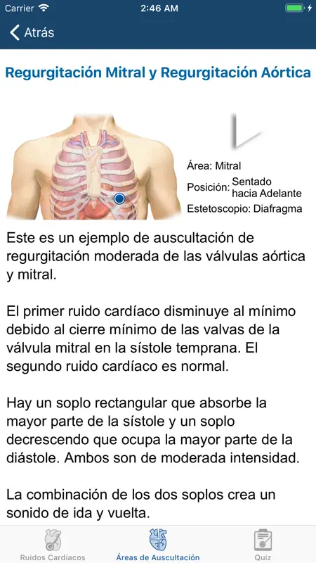 Heart Sounds Auscultation screenshot 6 of 6