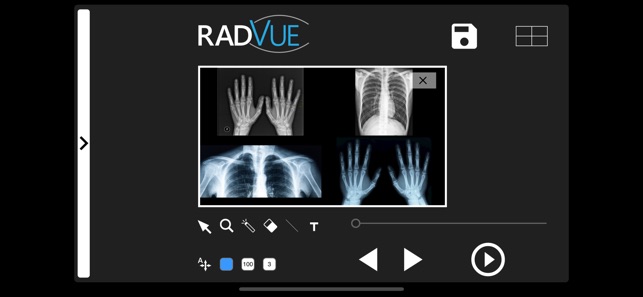 RADVUE(圖3)-速報App