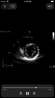 echosource iphone resimleri 3