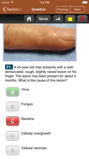 usmle images for the boards iphone screenshot 2
