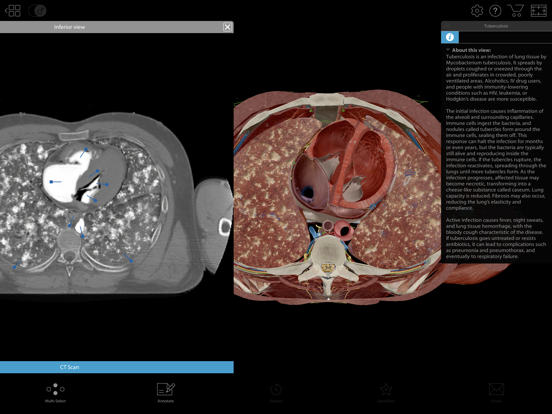 Physiology & Pathology iPad app afbeelding 9