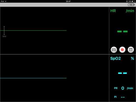 Screenshot #5 pour MonitorVitals