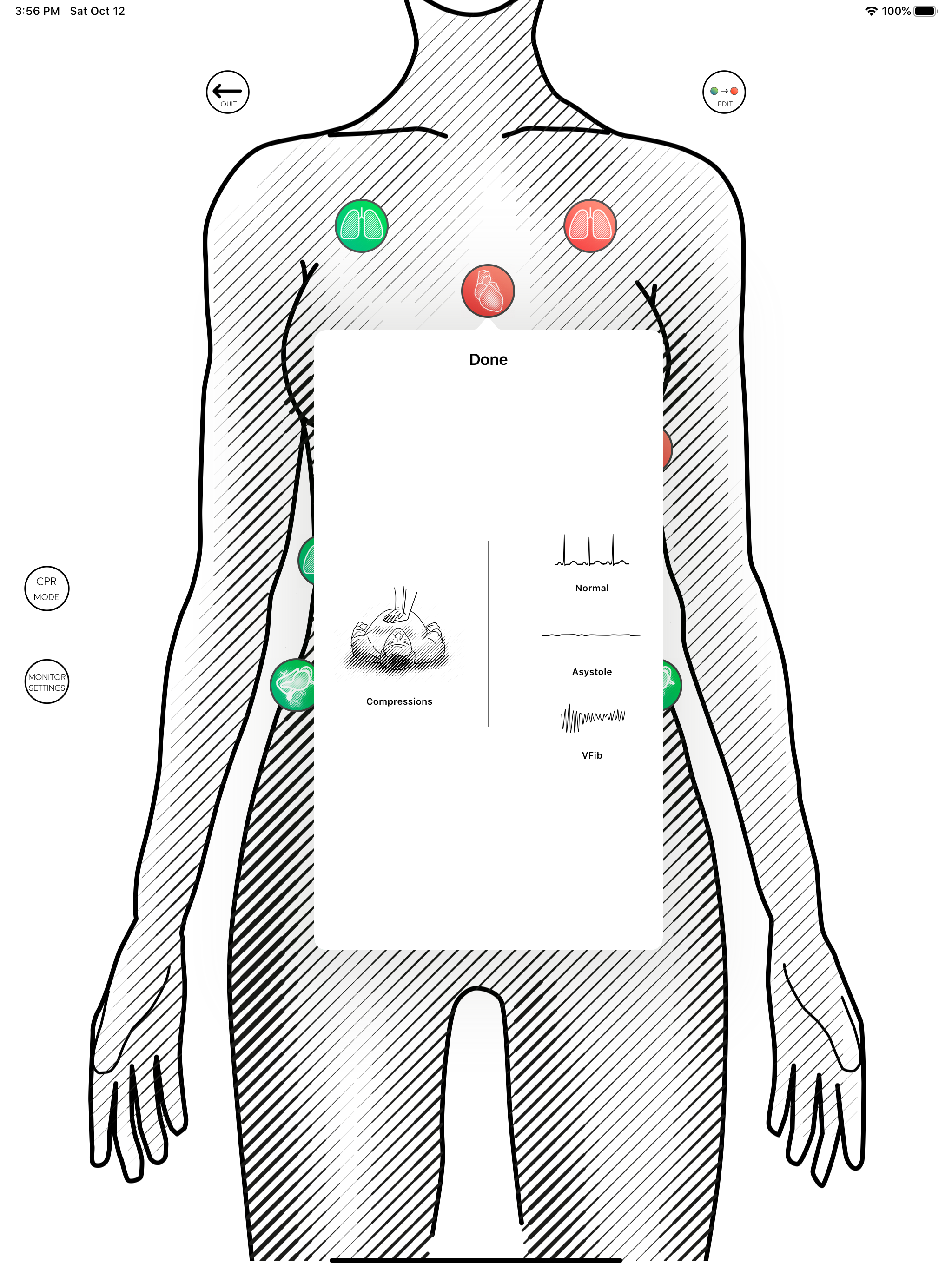 Awesome Ultrasound Simulator