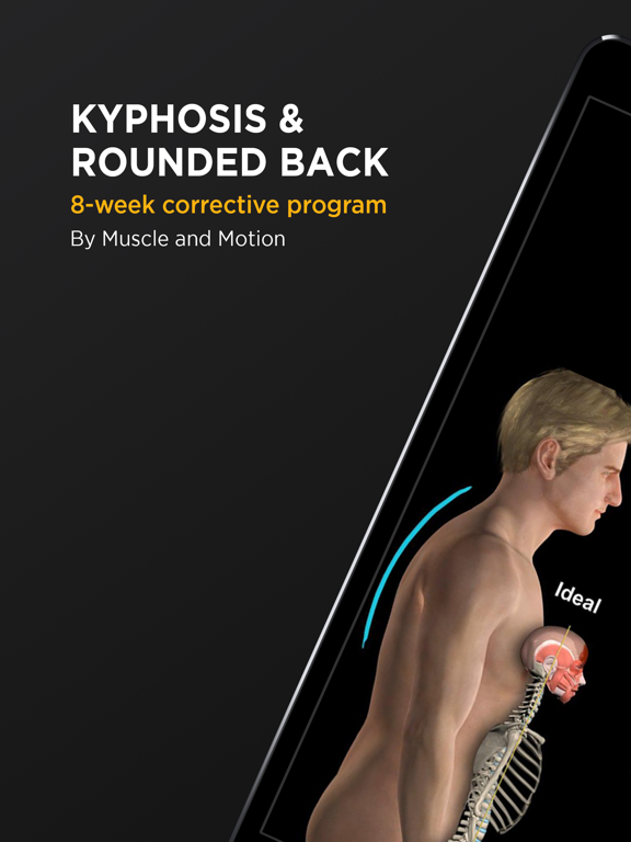 Screenshot #4 pour Kyphosis & Rounded Back