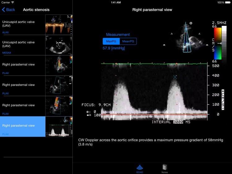 CARDIO3®Echocardiography HD