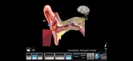 Game screenshot Ear Disorders: Outer Middle apk