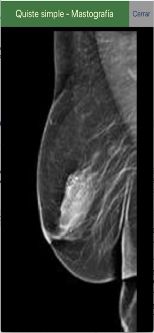 Telerradiología -Educativa(圖3)-速報App