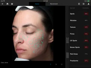 VISIA® screenshot 2