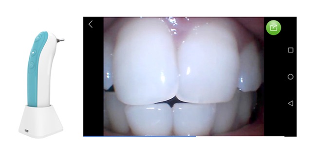 WIFI otoscope(圖4)-速報App