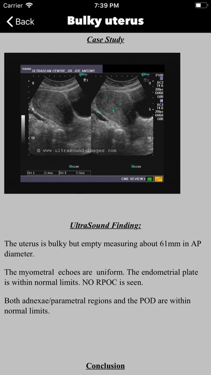 Ultrasound Guide Case Studies