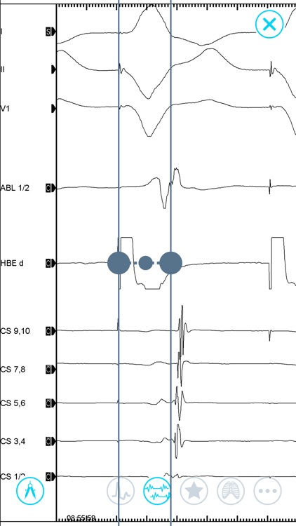 Cardiac Arrhythmia Challenge screenshot-5