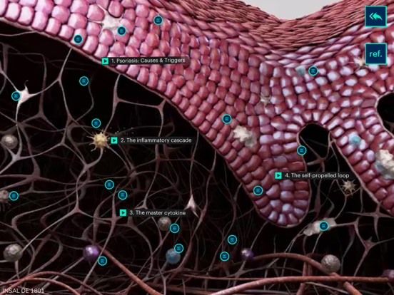 Screenshot #6 pour Psoriasis Deep Dive