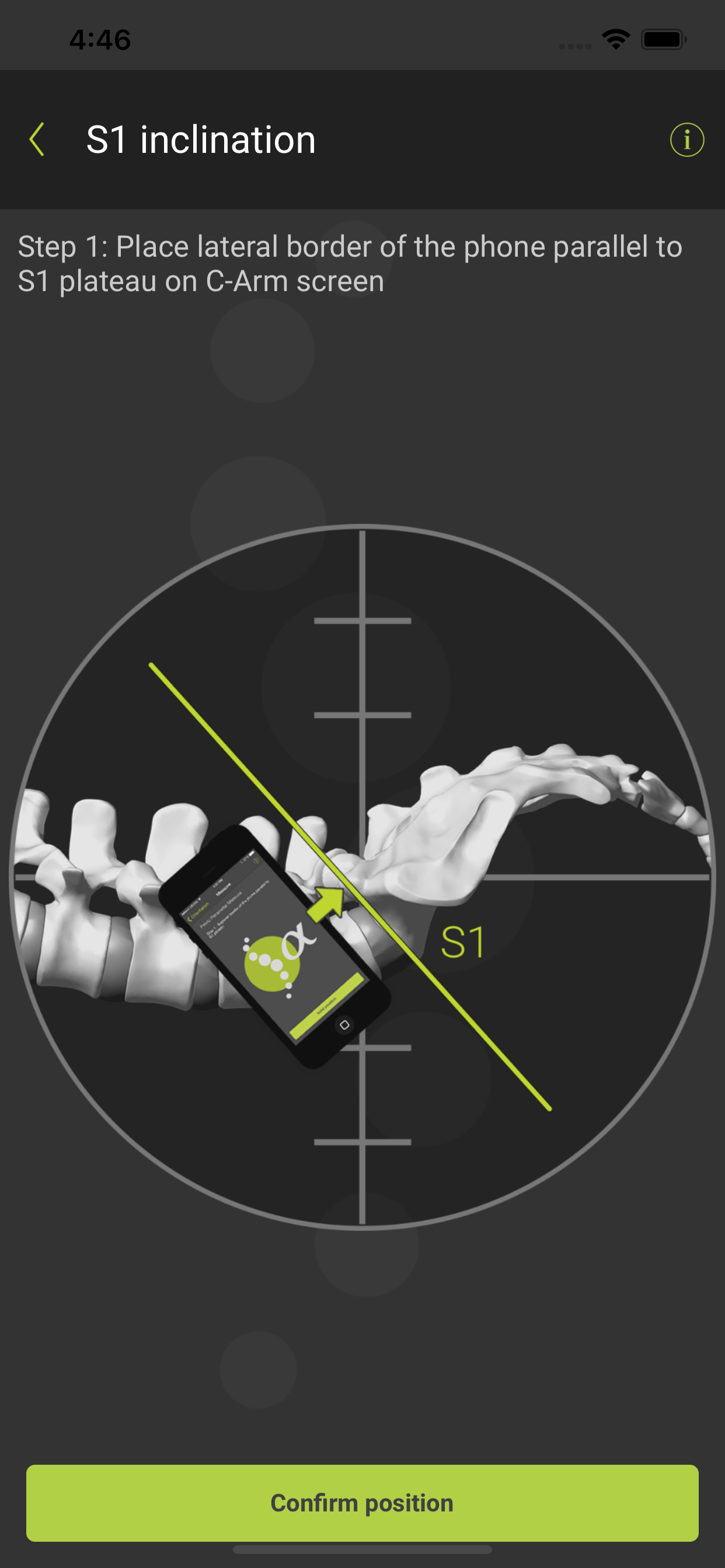 SagittalMeter Pro