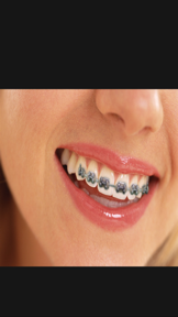 Orthodontic screenshot