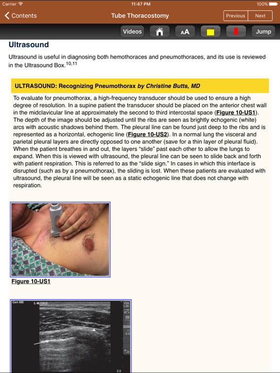 Screenshot #6 pour Roberts and Hedges 6th Edition