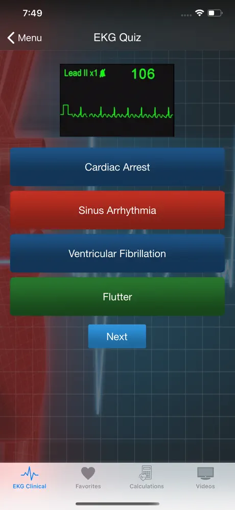 EKG Clinical