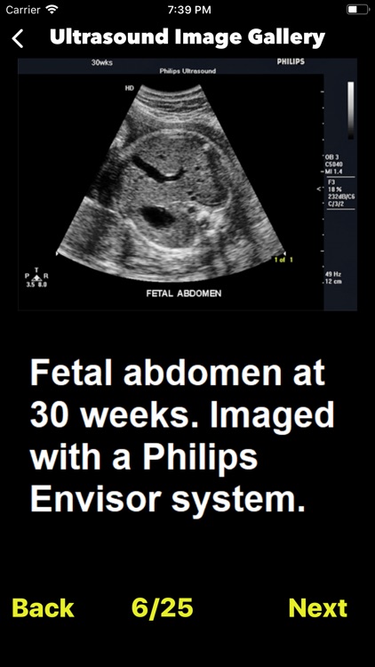 Ultrasound Guide Case Studies screenshot-5