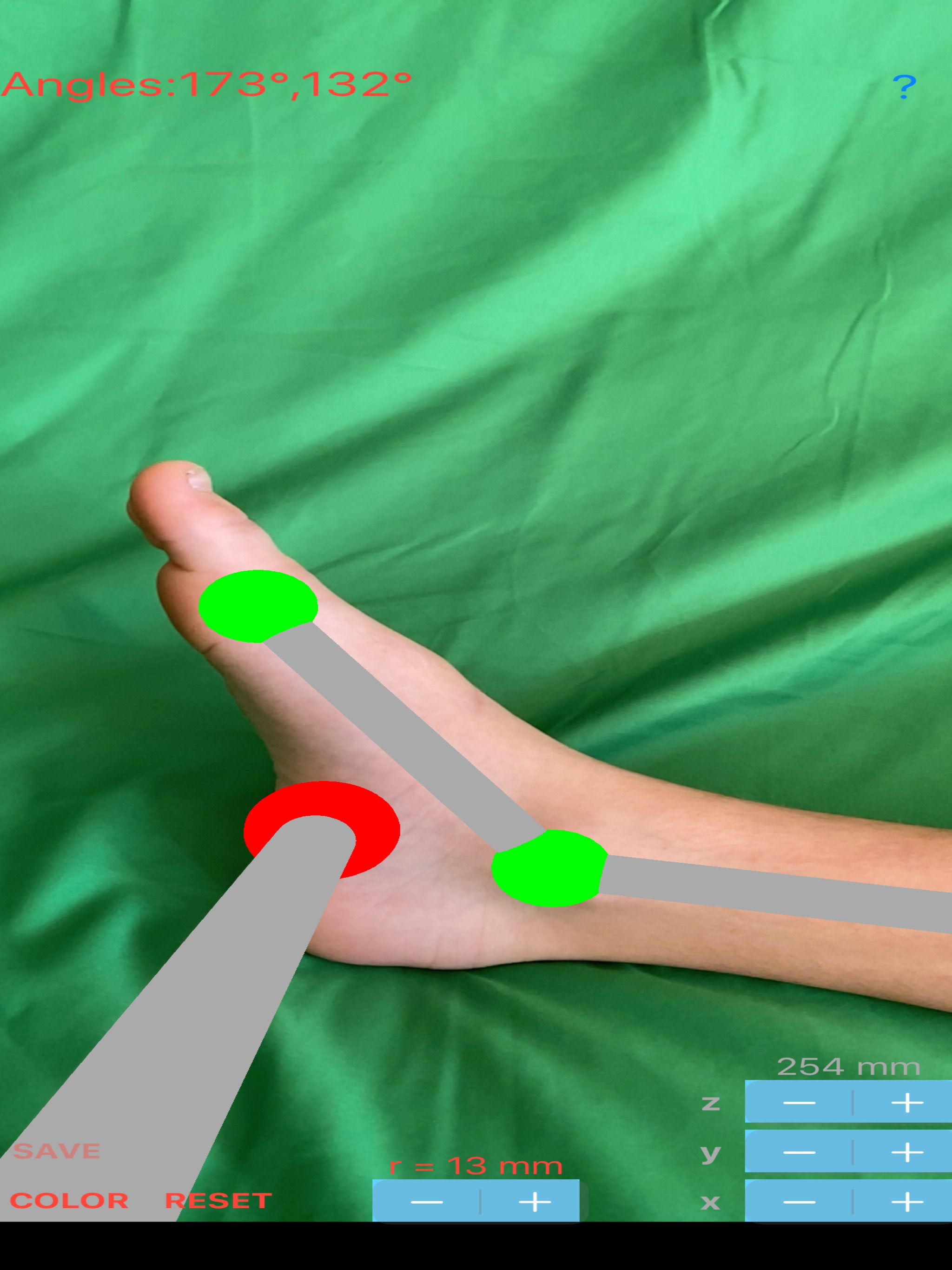 ARorthopaedicGoniometer screenshot 14