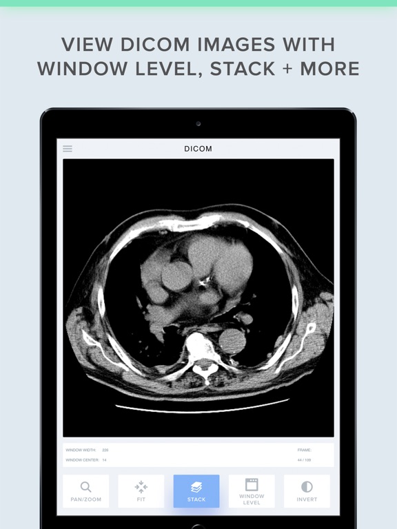 Screenshot #4 pour LEADTOOLS DICOM Viewer App