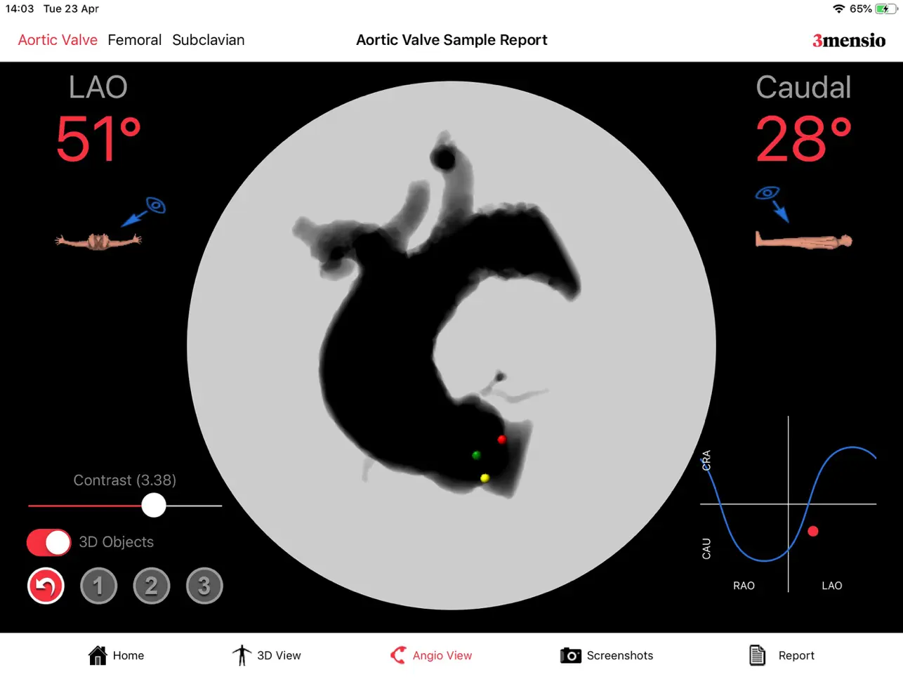 Screenshot #4 pour 3mensio Report