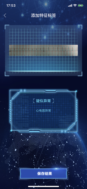 AI识心电(圖5)-速報App