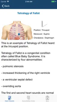 Heart Sounds Auscultation iphone bilder 2