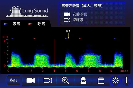 肺の聴診トレーニング - 見える肺音