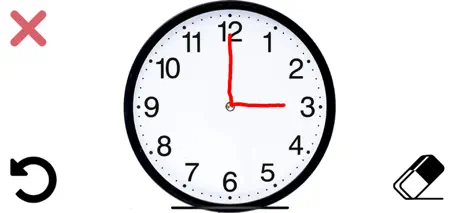 Gong aphasie