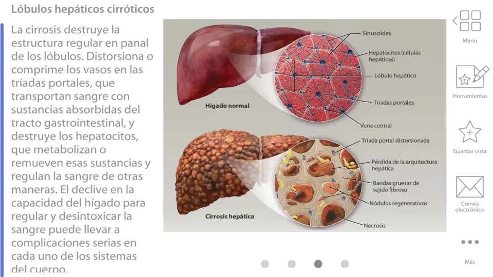 Captura de pantalla de Fisiología & Patología en iPhone 10
