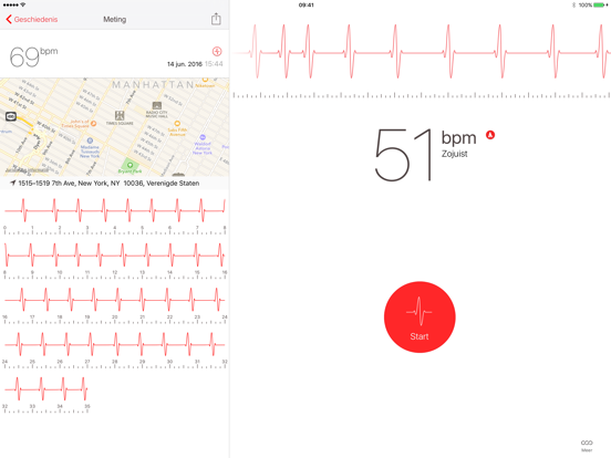 Cardiograaf iPad app afbeelding 1