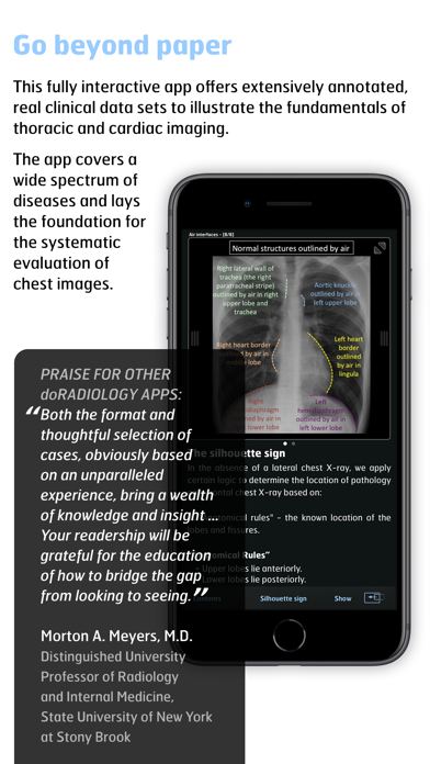 Screenshot #2 pour Thoracic Imaging Fundamentals