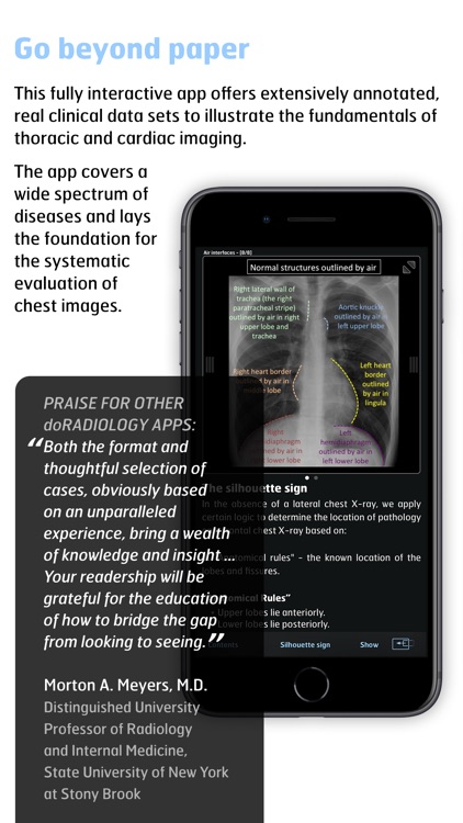 Thoracic Imaging Fundamentals